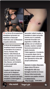 Gaza, Torture a un Bimbo di 18 Mesi. I$r@ele Sta Scavando sotto Al Aqsa? L'Accusa di uno Scienziato. gaza bambino torture